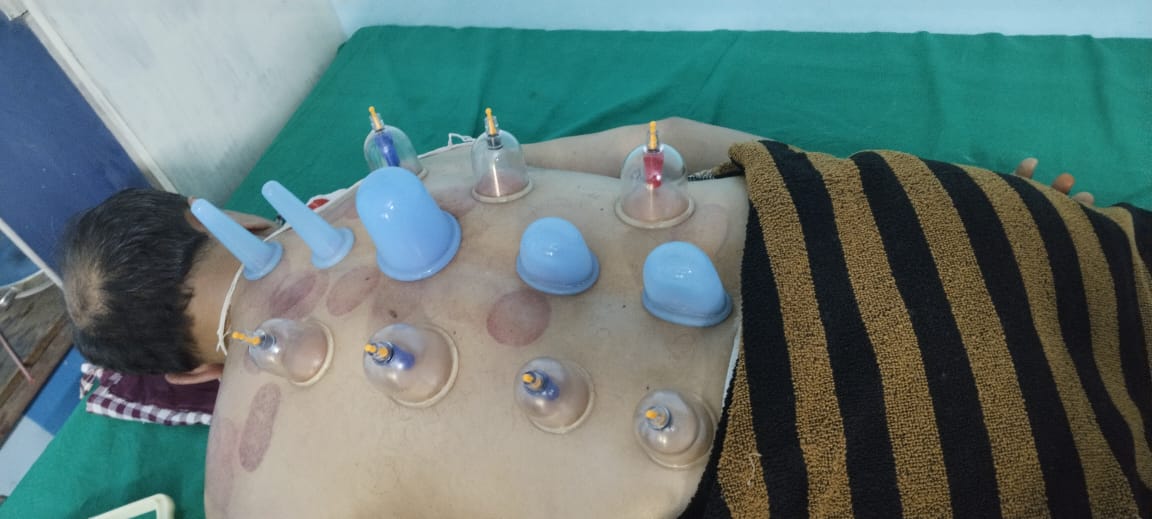 DCT - Diploma in Cupping Therapy
